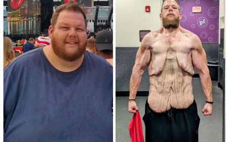 Cole Prochaska Incredible Weight Loss: Dropping 360 Pounds, Still Facing Loose Skin Worries