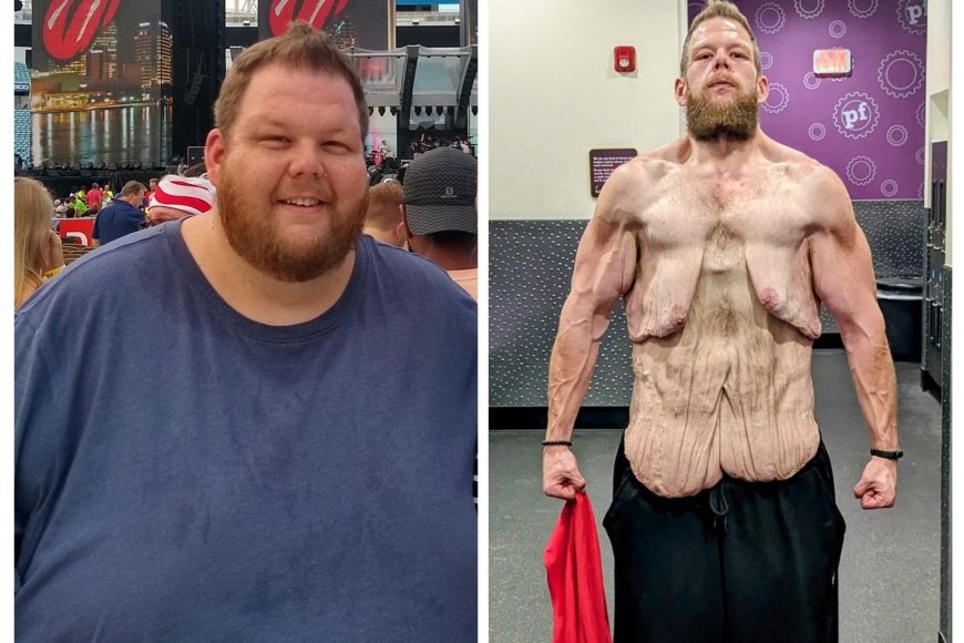 Cole Prochaska Incredible Weight Loss: Dropping 360 Pounds, Still Facing Loose Skin Worries