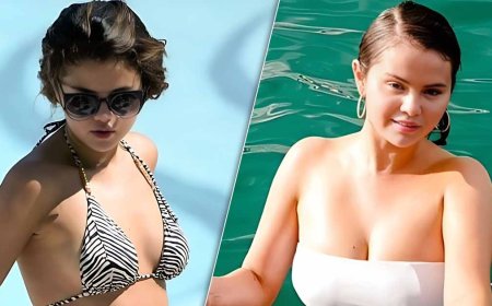 Selena Gomez Proudly Flaunts Her Body in Before-and-After Bikini Shots – Imperfectly Perfect and Proud!